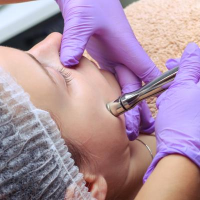 Mikrodermabrasion