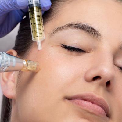 Microneedling